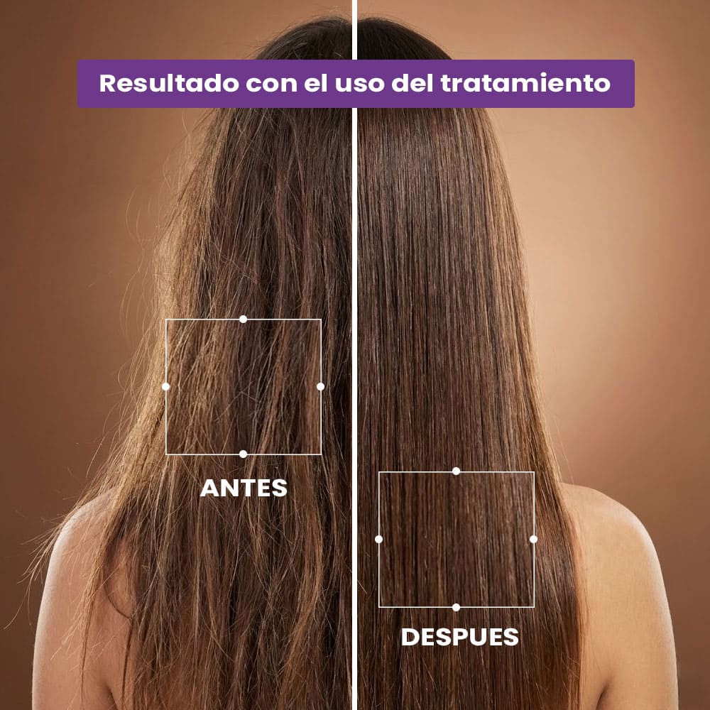 Tratamiento Intensivo de Recuperación Capilar